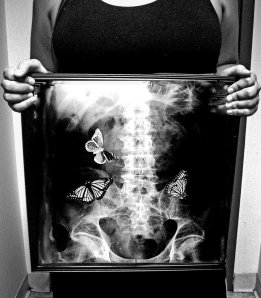 butterflies-xray